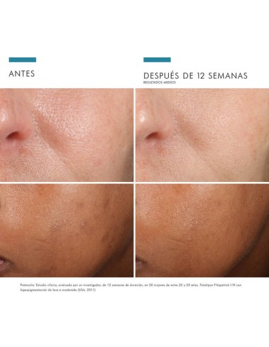 SKINCEUTICALS Phloretin CF 30ml