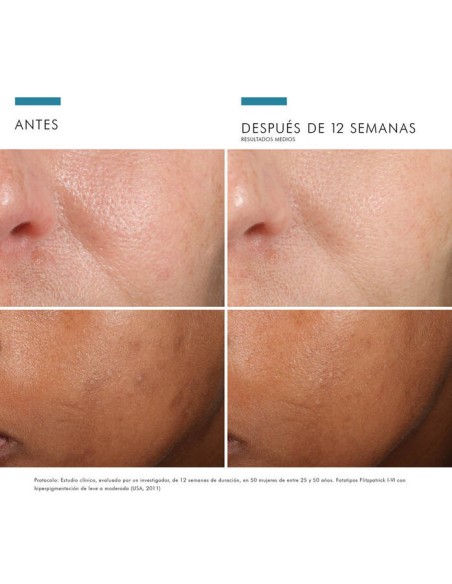 SKINCEUTICALS Phloretin CF 30ml