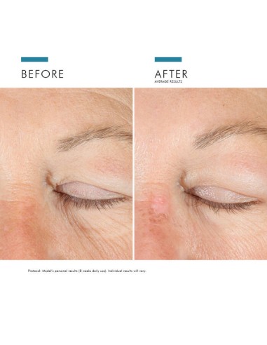 SKINCEUTICALS AGE Advance  Eye  15 ml
