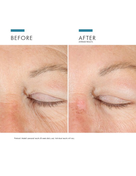 SKINCEUTICALS AGE Advance  Eye  15 ml