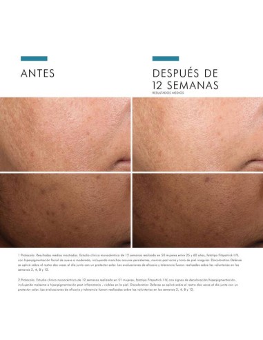 SKINCEUTICALS Discoloration Defense Serum 30ml