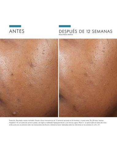 SKINCEUTICALS  Phyto A+ Brightening  30ml
