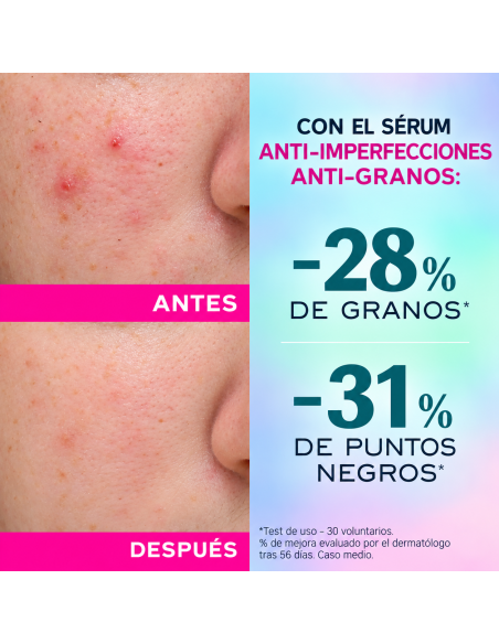 NUXE ZINC POER SERUM ANTI IMPERFECCIONES 30ml